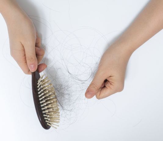 Alopecia Universalis (Haarausfall am ganzen Körper): Ursachen und Behandlung