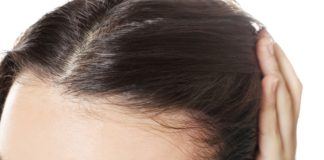 Geheimratsecken bei Frauen: Ursachen und Behandlung