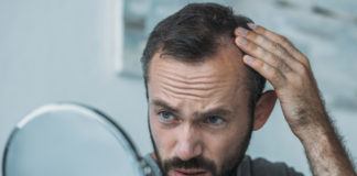 Minoxidil gegen Haarausfall: Wirkung, Nebenwirkungen, Anwendung