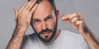 Erblich bedingter Haarausfall (Androgenetische Alopezie): Ursachen und Behandlung