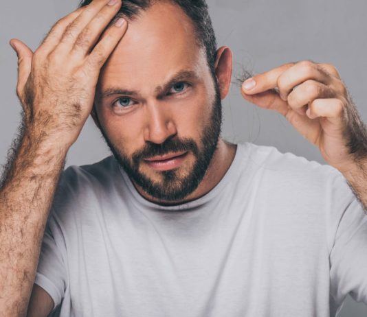 Erblich bedingter Haarausfall (Androgenetische Alopezie): Ursachen und Behandlung