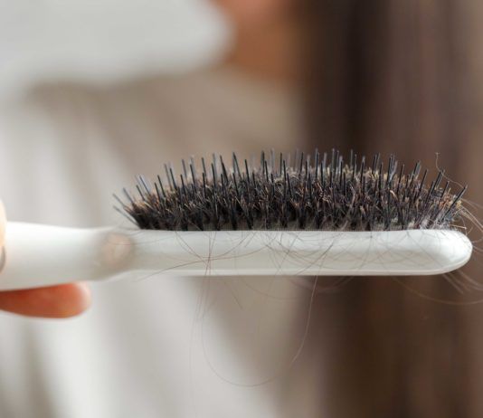 Haarausfall bei Hashimoto: Ursachen und was Sie dagegen tun können