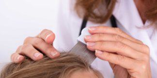 Haarausfall bei Kindern: Mögliche Ursachen – Ab wann ist ein Gang zum Arzt notwendig?