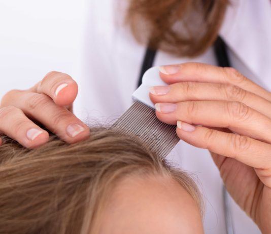 Haarausfall bei Kindern: Mögliche Ursachen – Ab wann ist ein Gang zum Arzt notwendig?