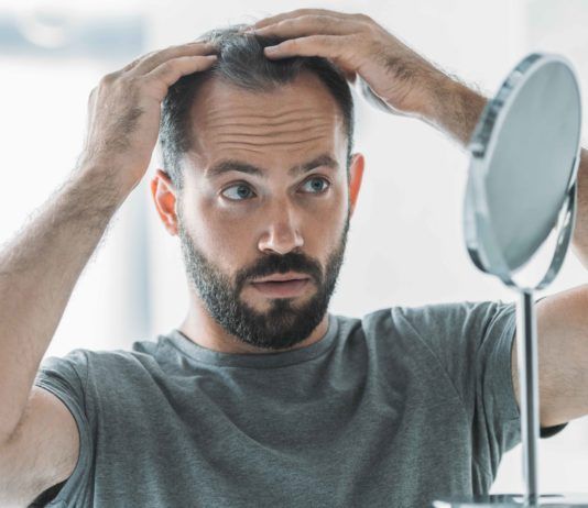 Haarausfall bei Männern: Ursachen und was Sie dagegen tun können