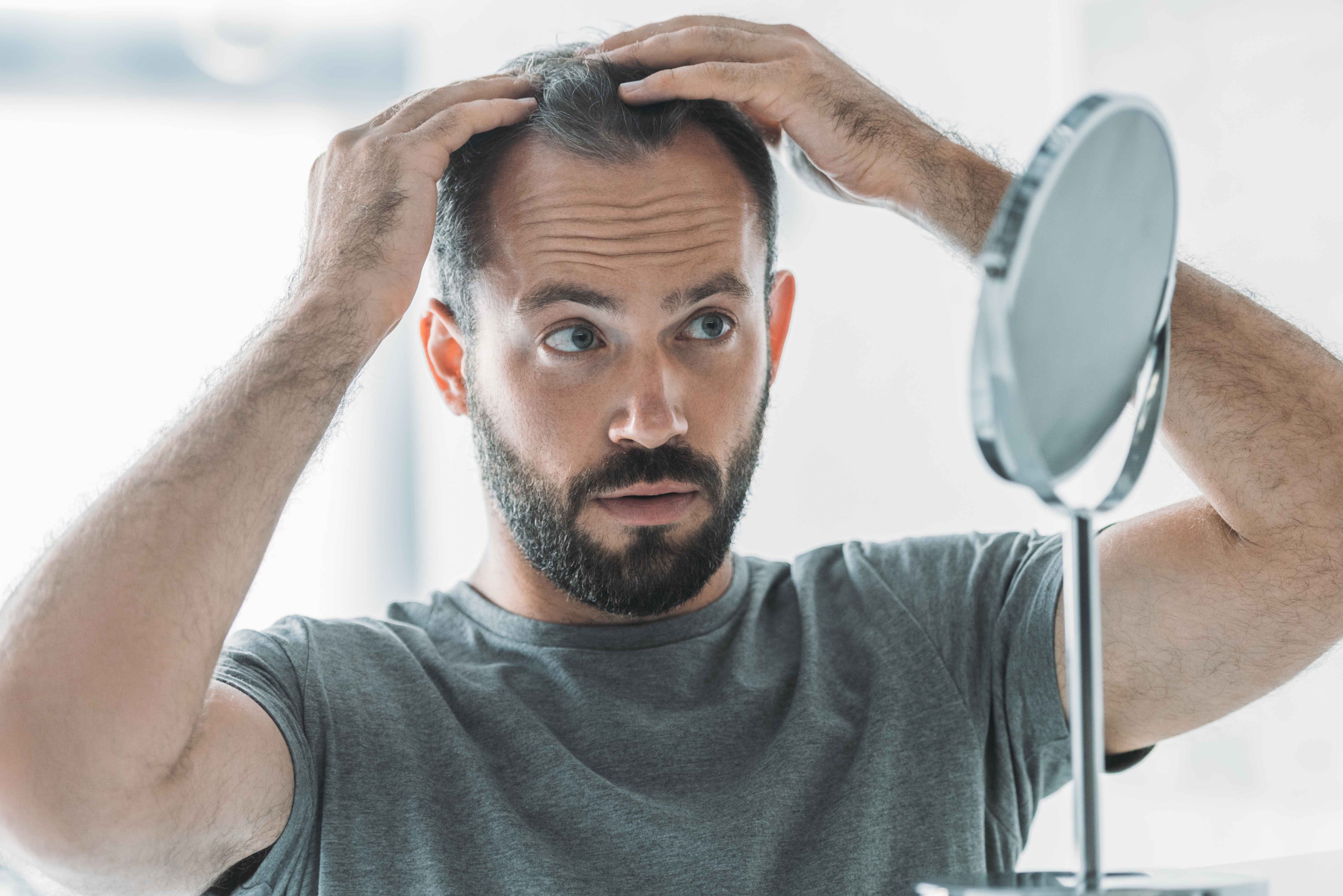 Haarausfall bei Männern Ursachen und was Sie dagegen tun