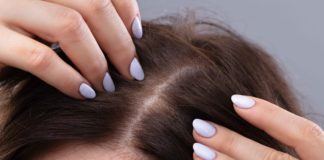 Juckende Kopfhaut und Haarausfall: Falsche Haarpflege oder Symptome einer Krankheit?