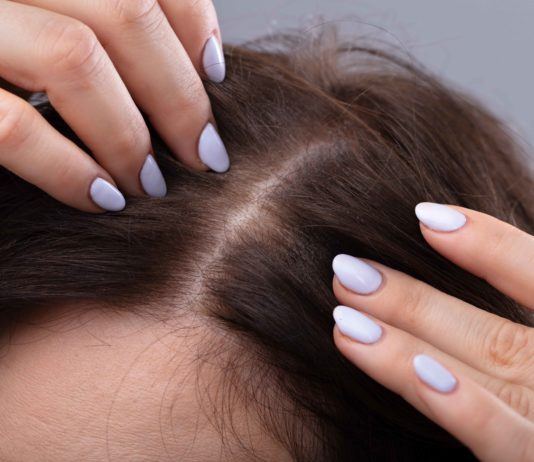 Juckende Kopfhaut und Haarausfall: Falsche Haarpflege oder Symptome einer Krankheit?