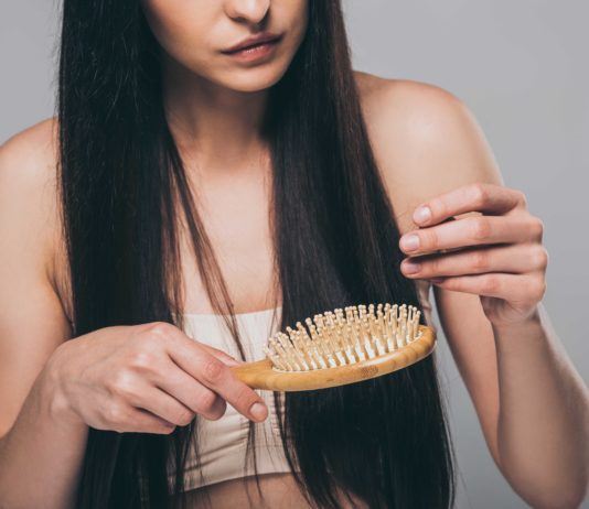 Kreisrunder Haarausfall (Alopecia Areata): Ursachen und Behandlung