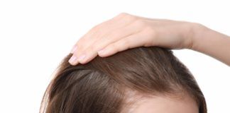 Kreisrunder Haarausfall bei Frauen: Ursachen & Behandlung