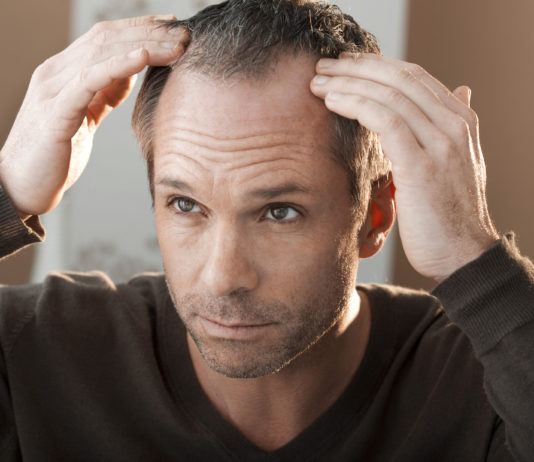 Was tun gegen Geheimratsecken? – Die besten Tipps und Mittel gegen Geheimratsecken!