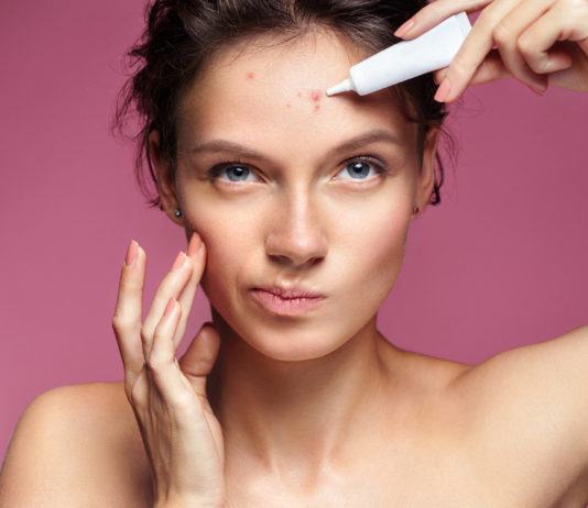 Zinksalbe gegen Pickel und Akne: Wie effektiv ist Zink tatsächlich?